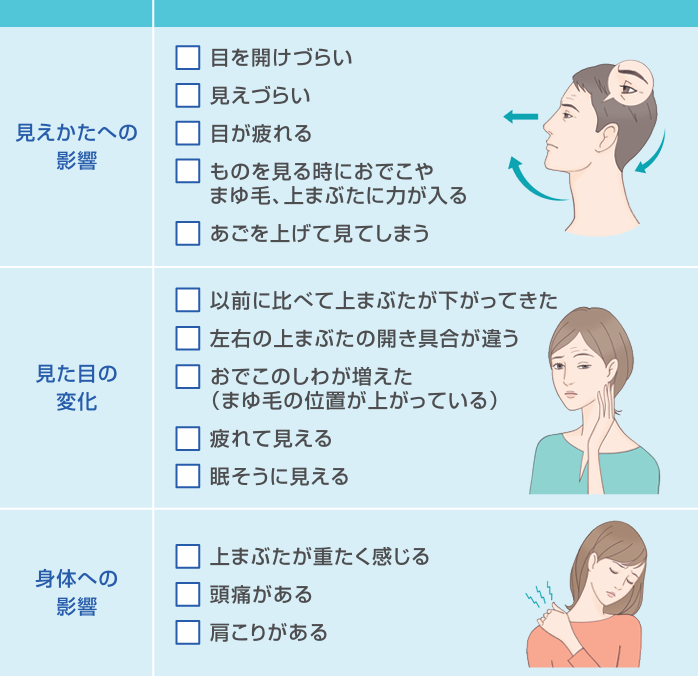 眼瞼下垂チェック