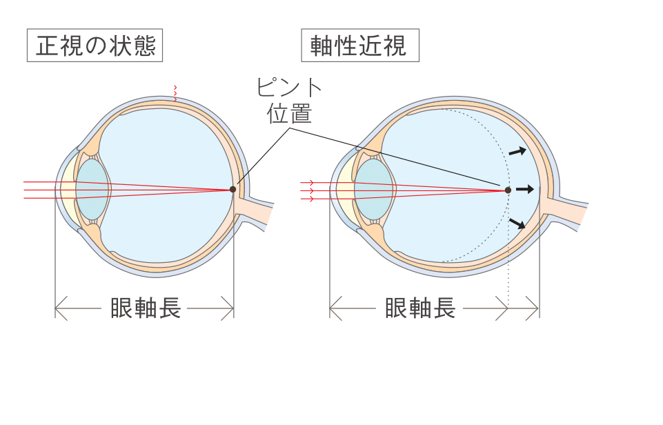 眼軸