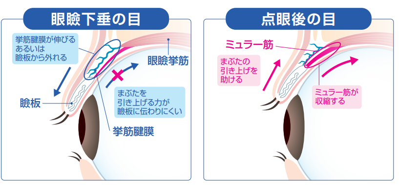 作用機序